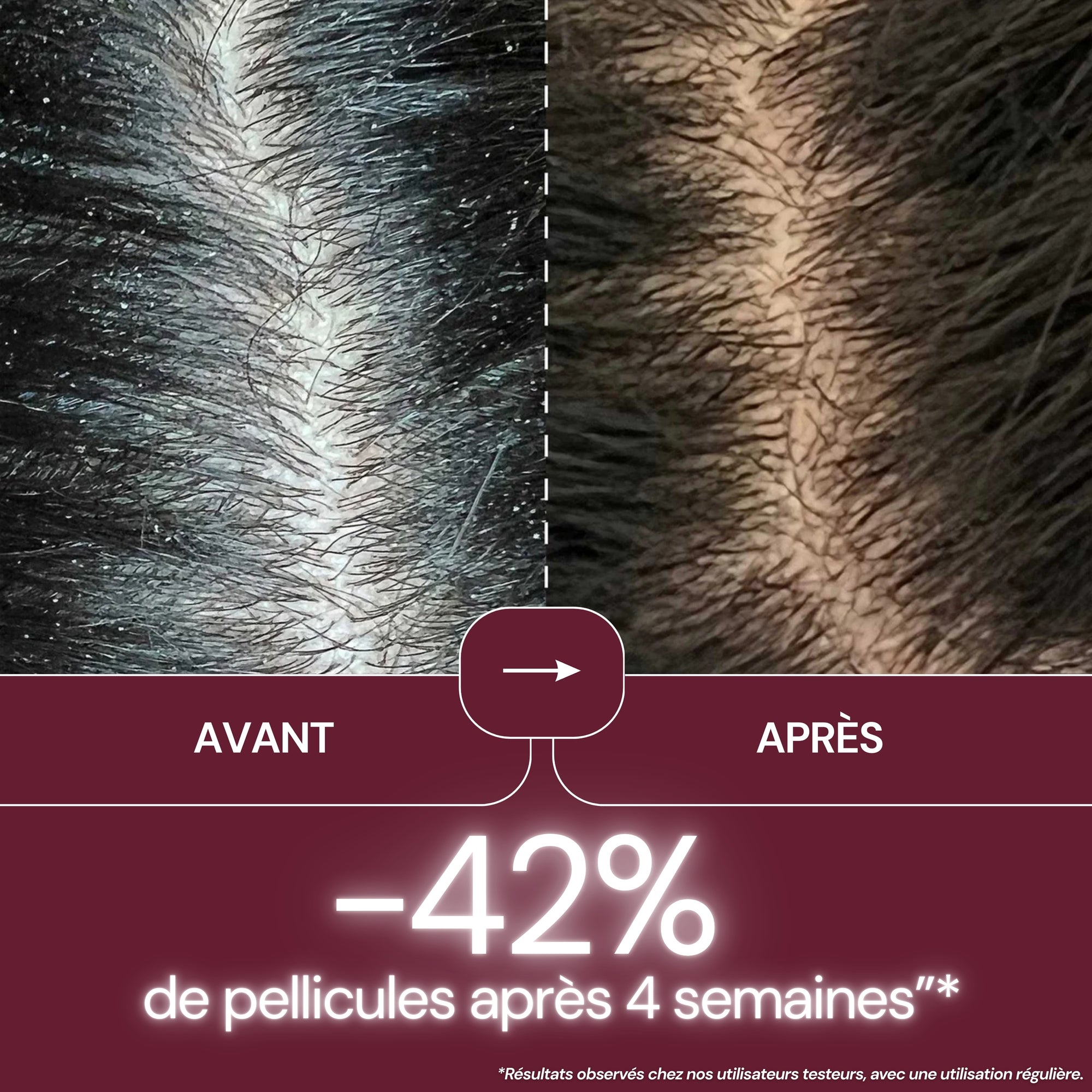 NeoGlow Comb™ - 3 en 1