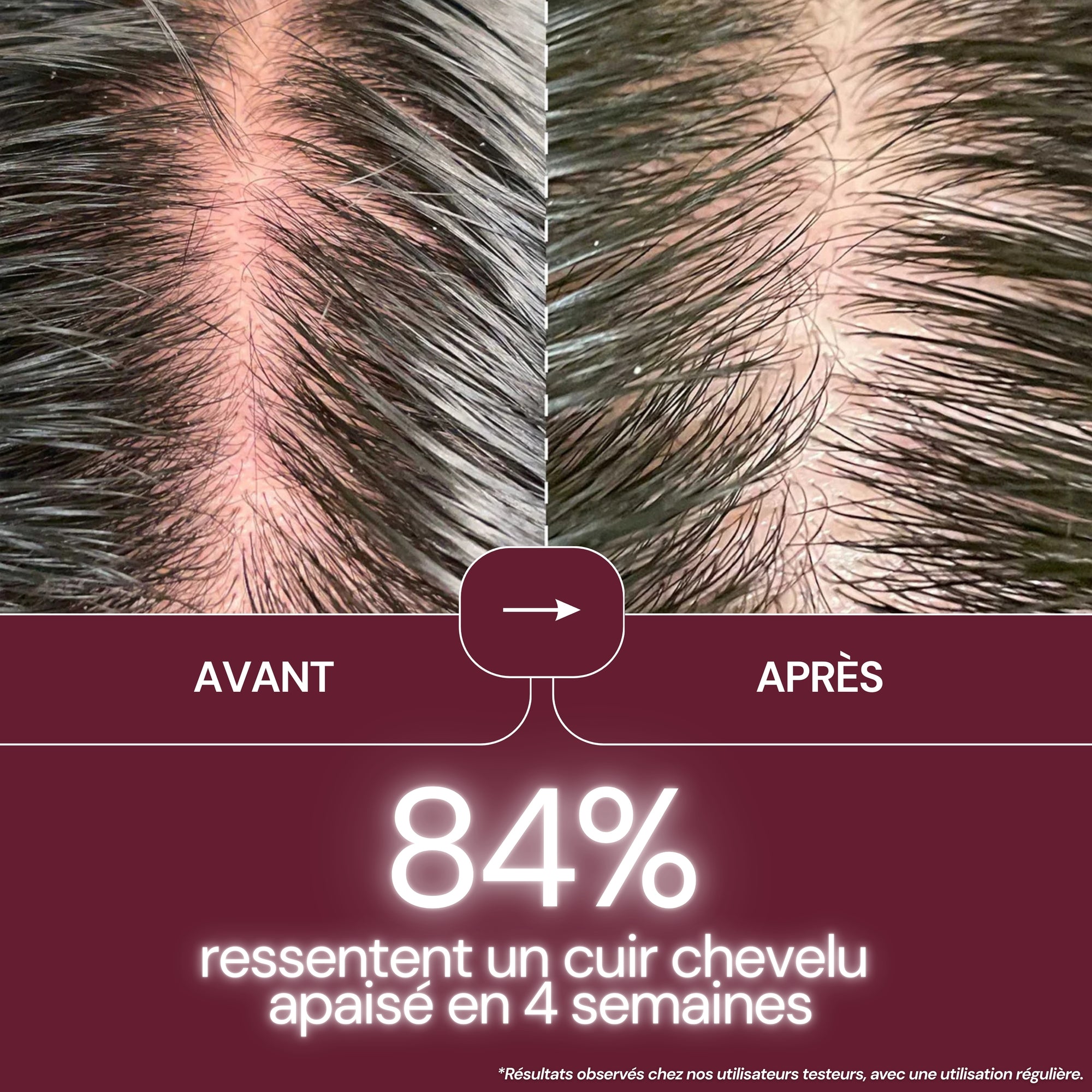 NeoGlow Comb™ - 3 en 1